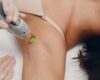Burns and Injuries From Laser Hair Removal: Who’s at Fault?